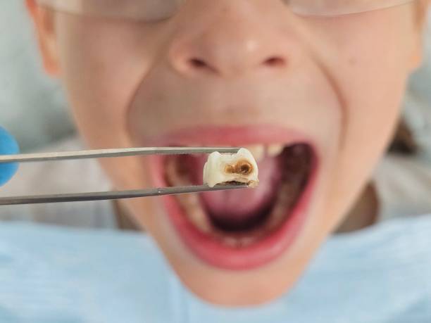 Best Emergency Gum Treatment in Haughton, LA